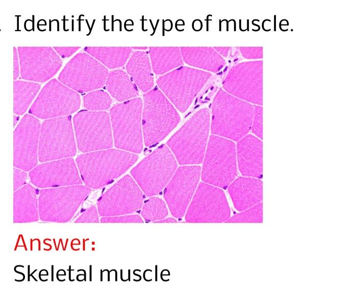 Solved Identify the type of muscle. Answer: Skeletal muscle | Chegg.com