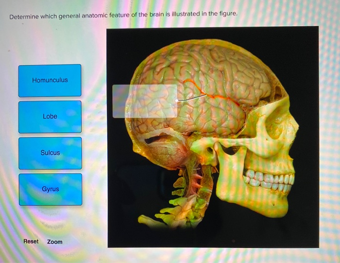 Solved Determine which general anatomic feature of the brain | Chegg.com