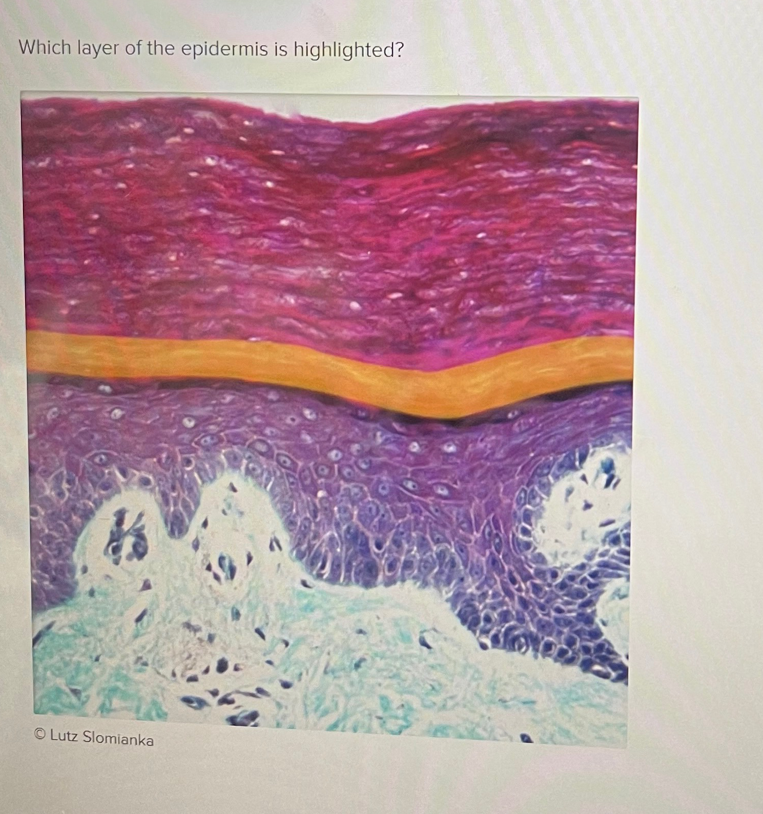 Solved Which layer of the epidermis is highlighted? | Chegg.com