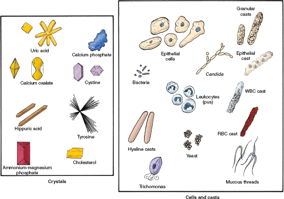 Solved: Make a sketch for each type of sediment you observed. Labe ...