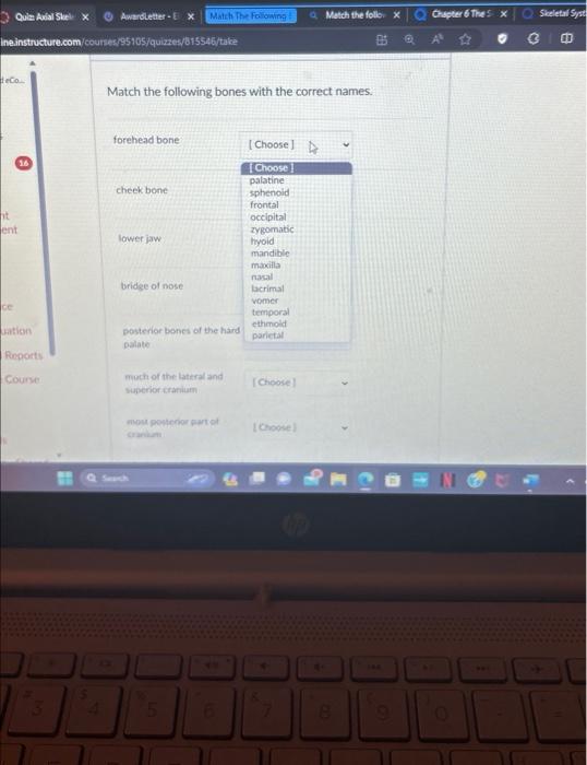 Solved Match the following bones with the correct names. | Chegg.com