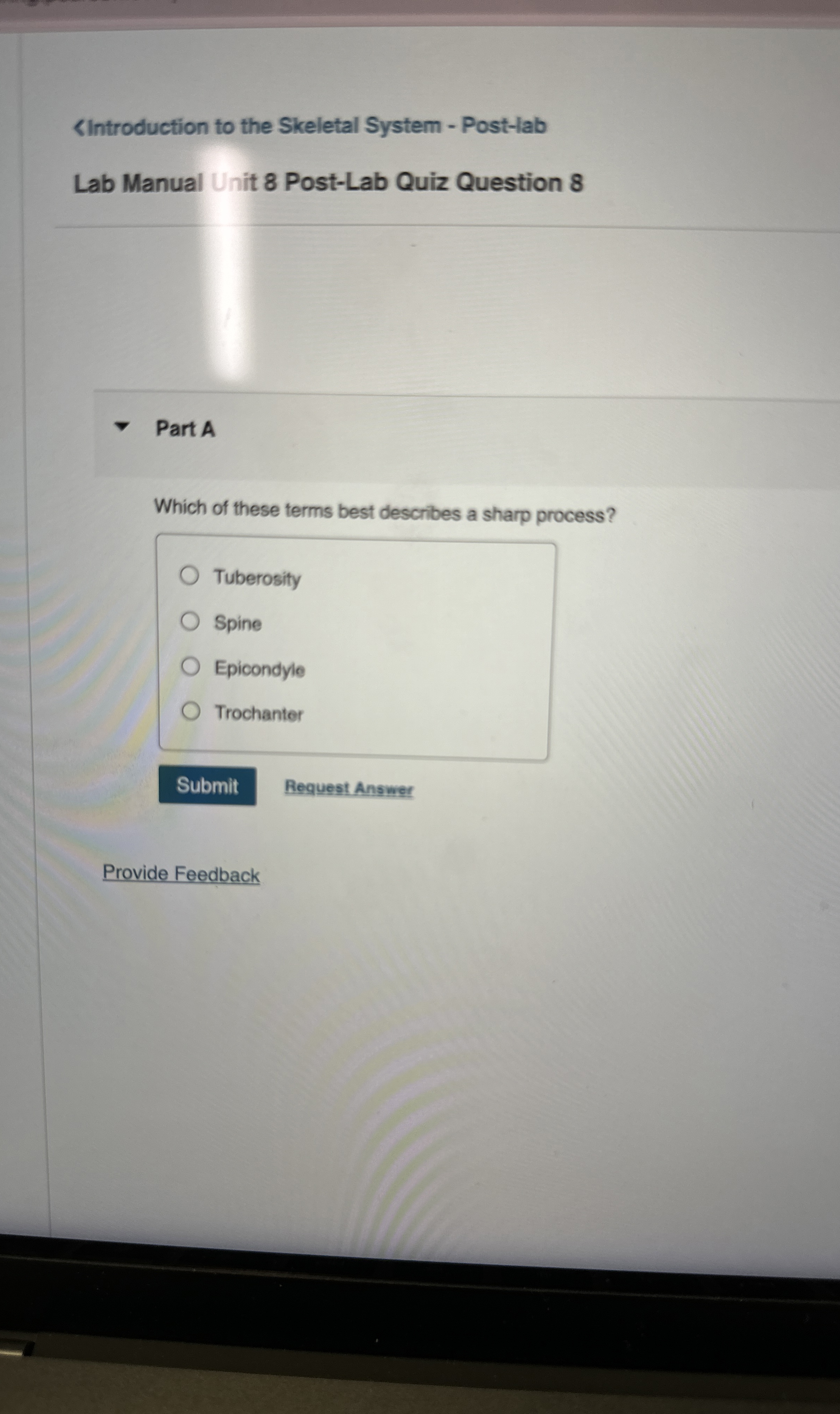 Solved Part AWhich of these terms best describes a sharp | Chegg.com