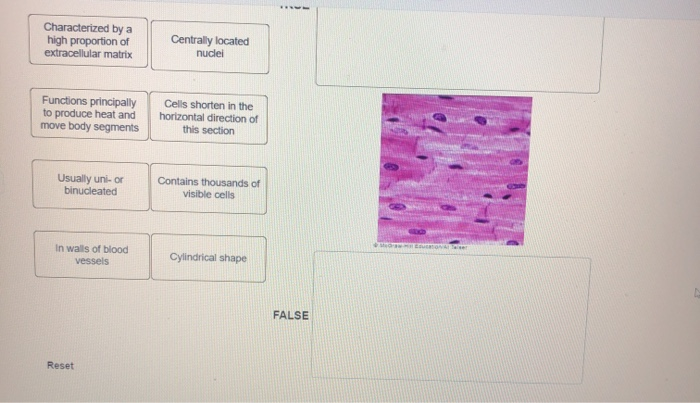 Solved Characteristics of One Type of Muscle Tissue Identify | Chegg.com