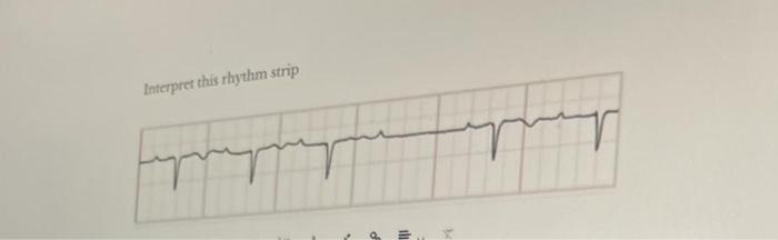 Interpret this rhythm strip | Chegg.com