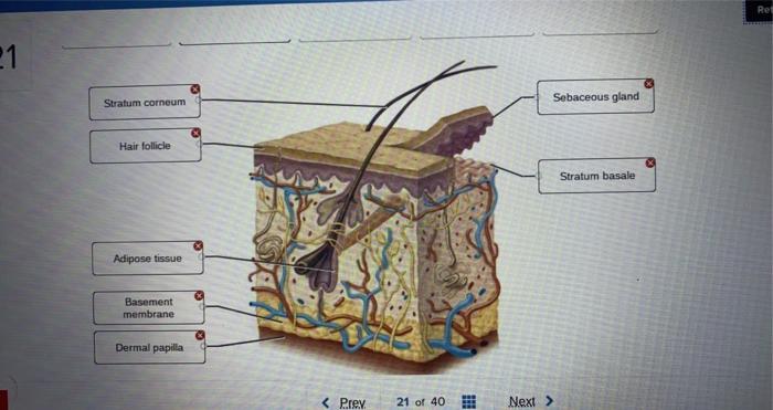 Solved Ret 21 Stratum corneum Sebaceous gland Hair follicle | Chegg.com