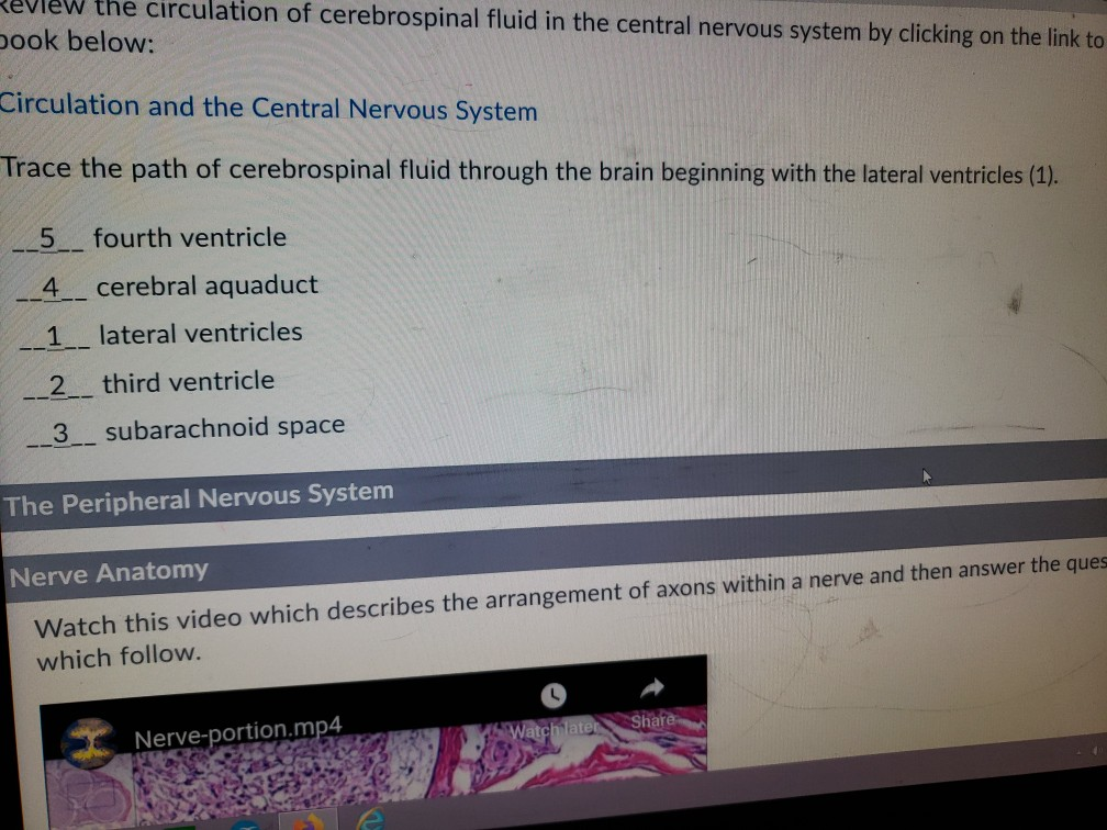 Solved Review the circulation of cerebrospinal fluid in the | Chegg.com