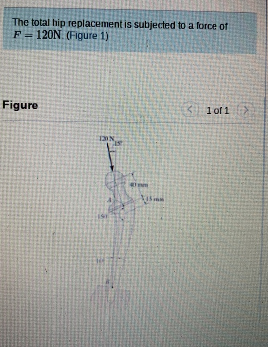 Solved The total hip replacement is subjected to a force of | Chegg.com