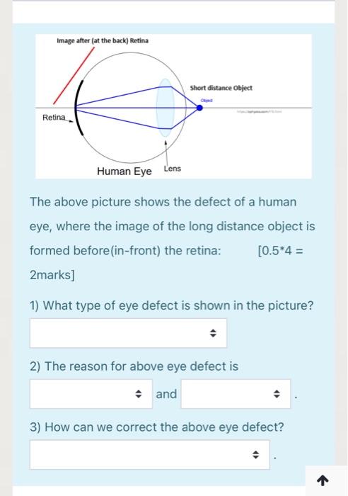 Solved Image after at the back) Retina Short distance Object | Chegg.com