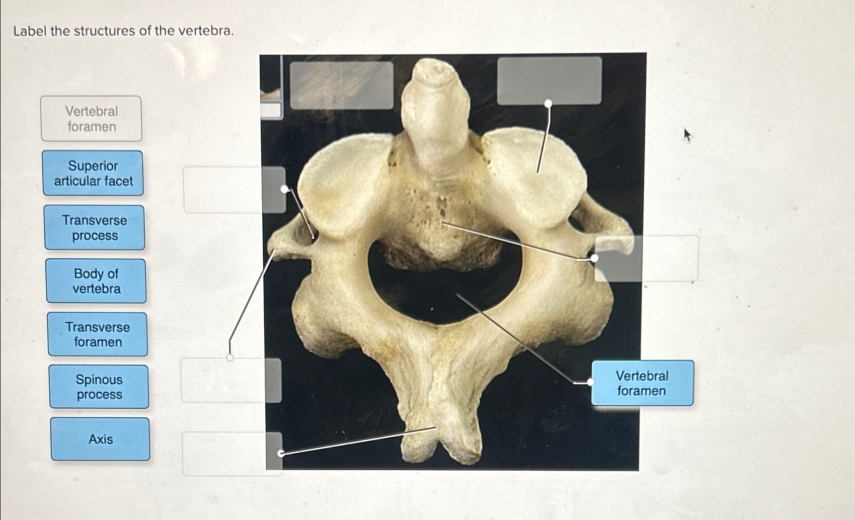 Label the structures of the vertebraTransverse | Chegg.com