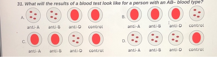 Solved 31. What Will The Results Of A Blood Test Look Like | Chegg.com