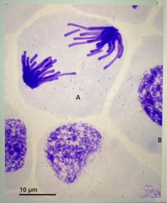 Solved The image is of a cells in the cell cycle. Identify | Chegg.com