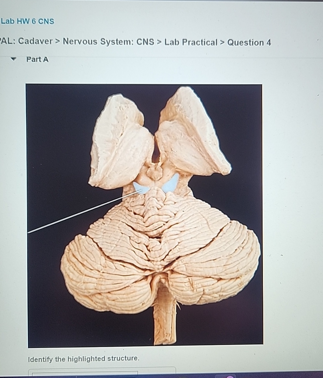 Solved Lab HW 6 ﻿CNSAL: Cadaver > ﻿Nervous System: CNS > | Chegg.com