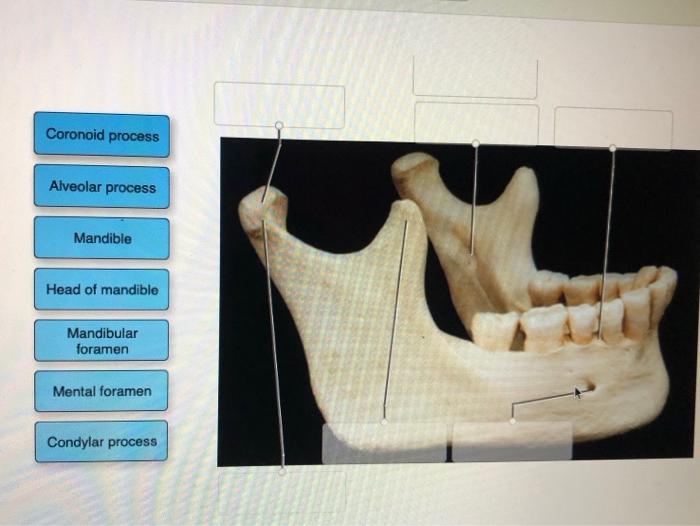 Solved Coronoid process Alveolar process Mandible Head of