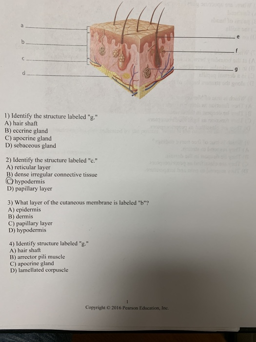 1) Identify the structure labeled 