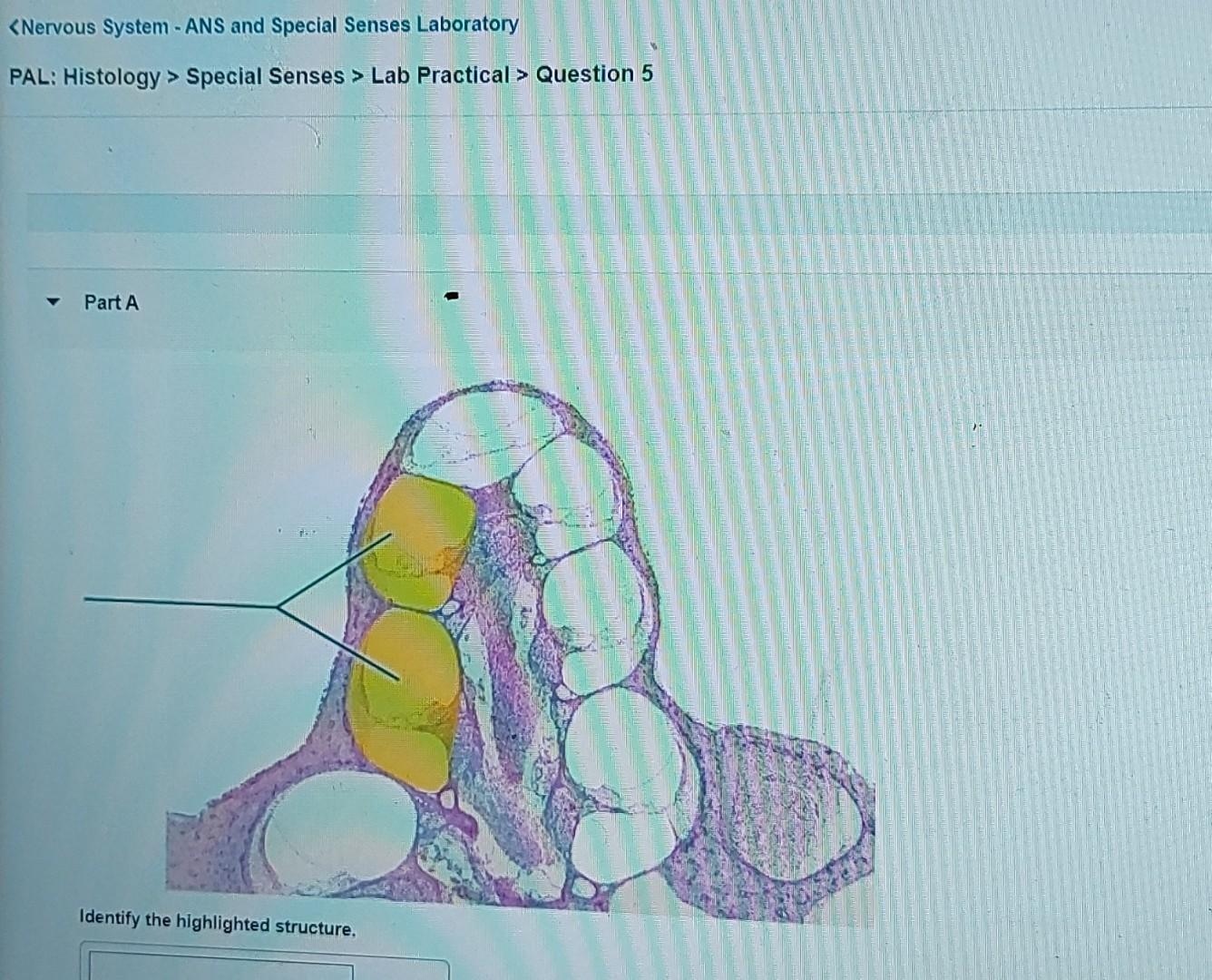 Solved Special Senses > Lab Practical > Question 5 Part A | Chegg.com