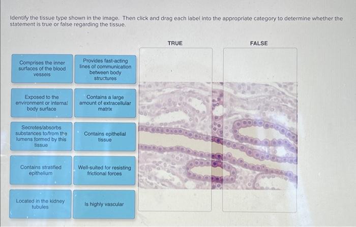 Solved Identify The Tissue Type Shown In The Image. Then | Chegg.com