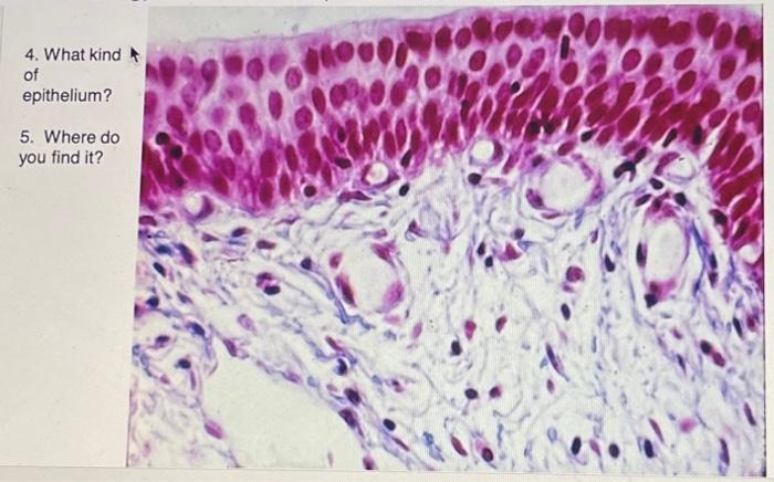 Solved 4. What kind of epithelium? 5. Where do you find it? | Chegg.com