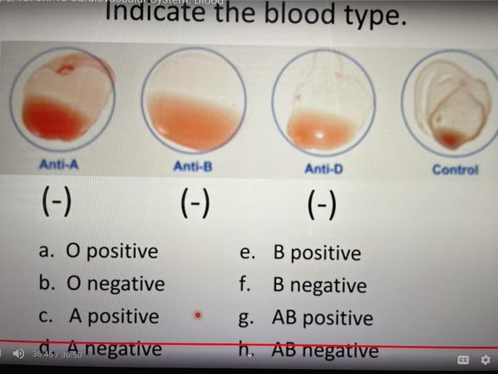 Solved Indicate The Blood Type Anti A Anti B Anti D Control Chegg Com