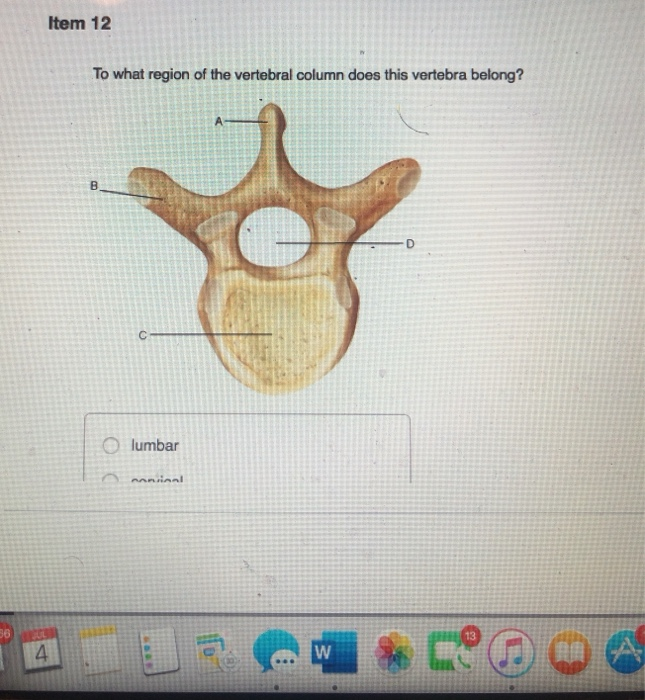 Solved Item 12 To what region of the vertebral column does | Chegg.com