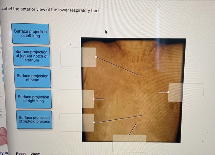 Solved Label the anterior view of the lower respiratory | Chegg.com