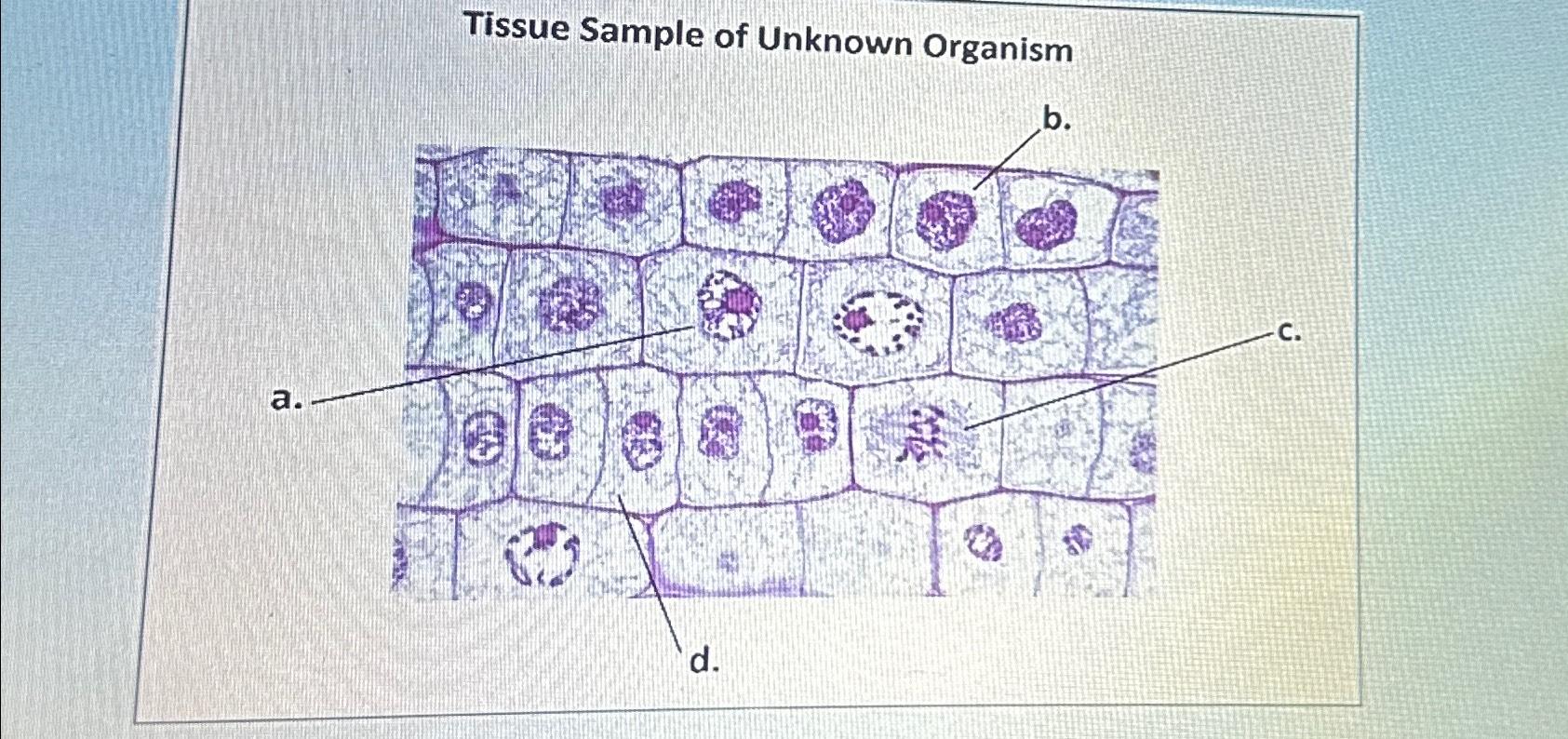 Solved The majority of cells pictured in the tissue sample | Chegg.com