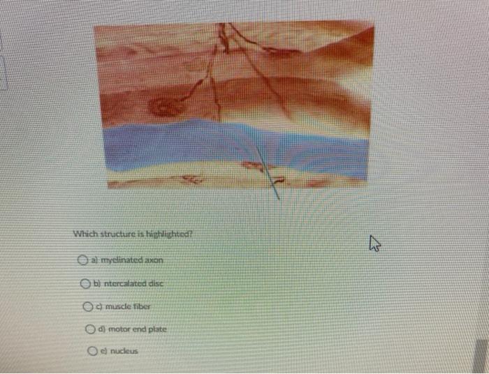 solved-which-structure-is-highlighted-al-myelinated-axon-b-chegg