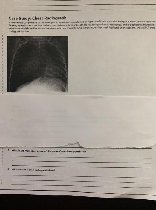 Case Study: Chest Radiograph A 10-year-old boy presents to the emergency department complaining of right-sided chest pain aft