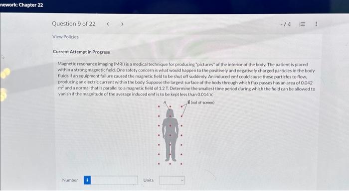 Solved Magnetic Resonance Imaging (MRI) Is A Medical | Chegg.com