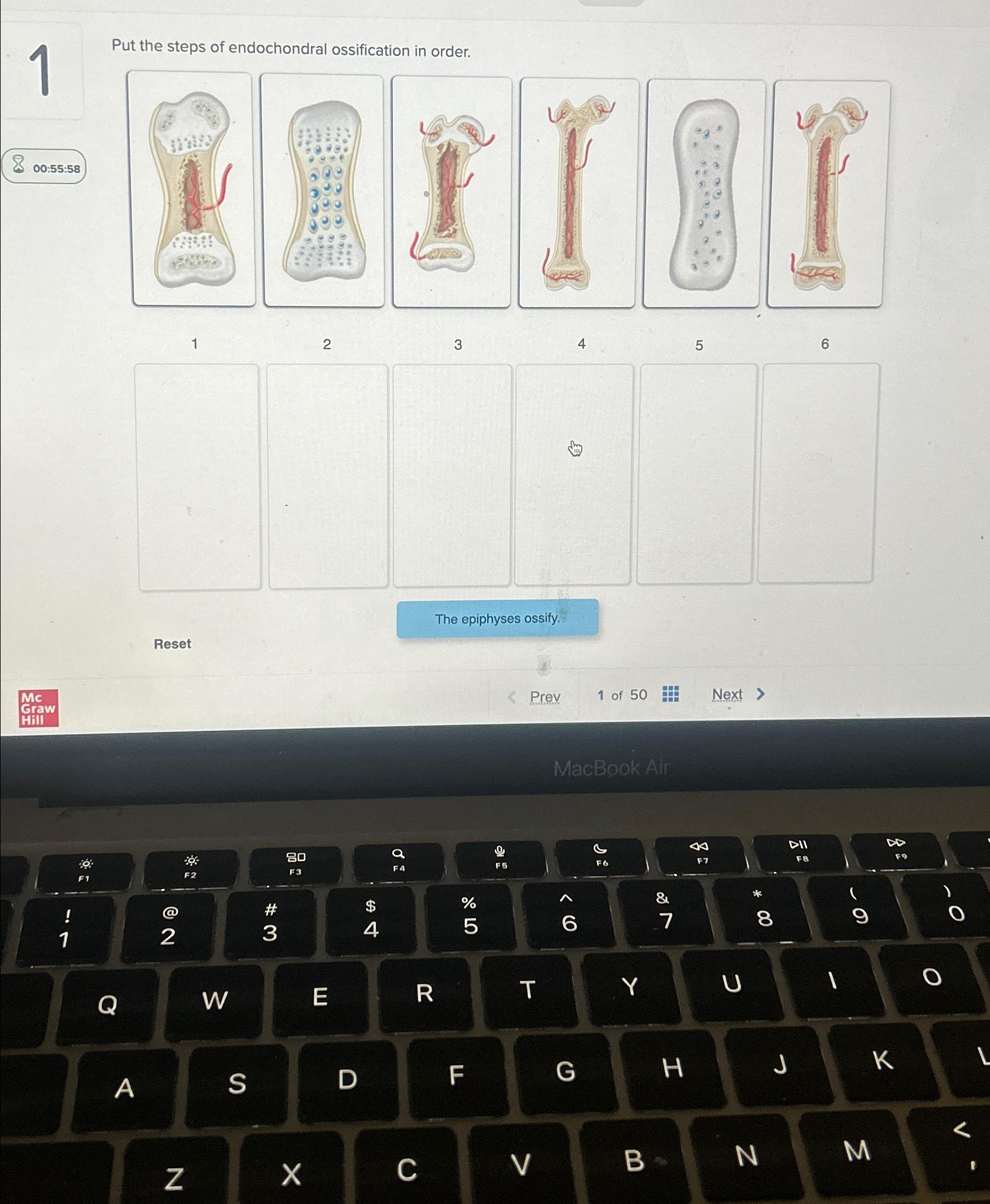 Solved 100:55:58Put the steps of endochondral ossification | Chegg.com