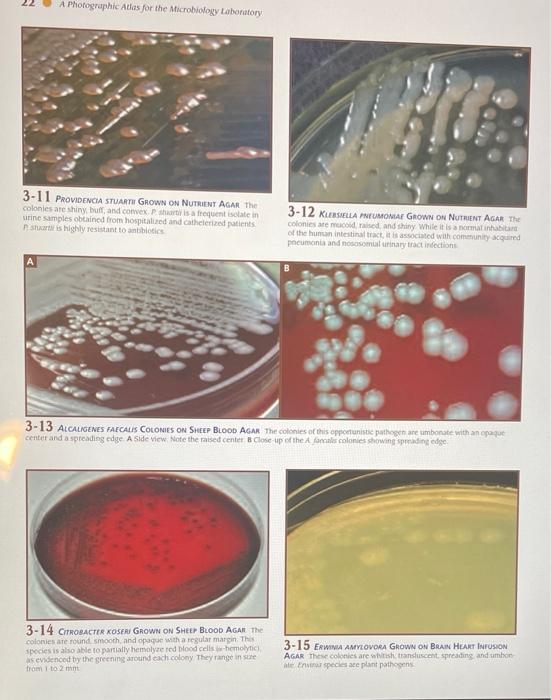 Solved Laboratory Exercise 13 Bacterial Isolation and