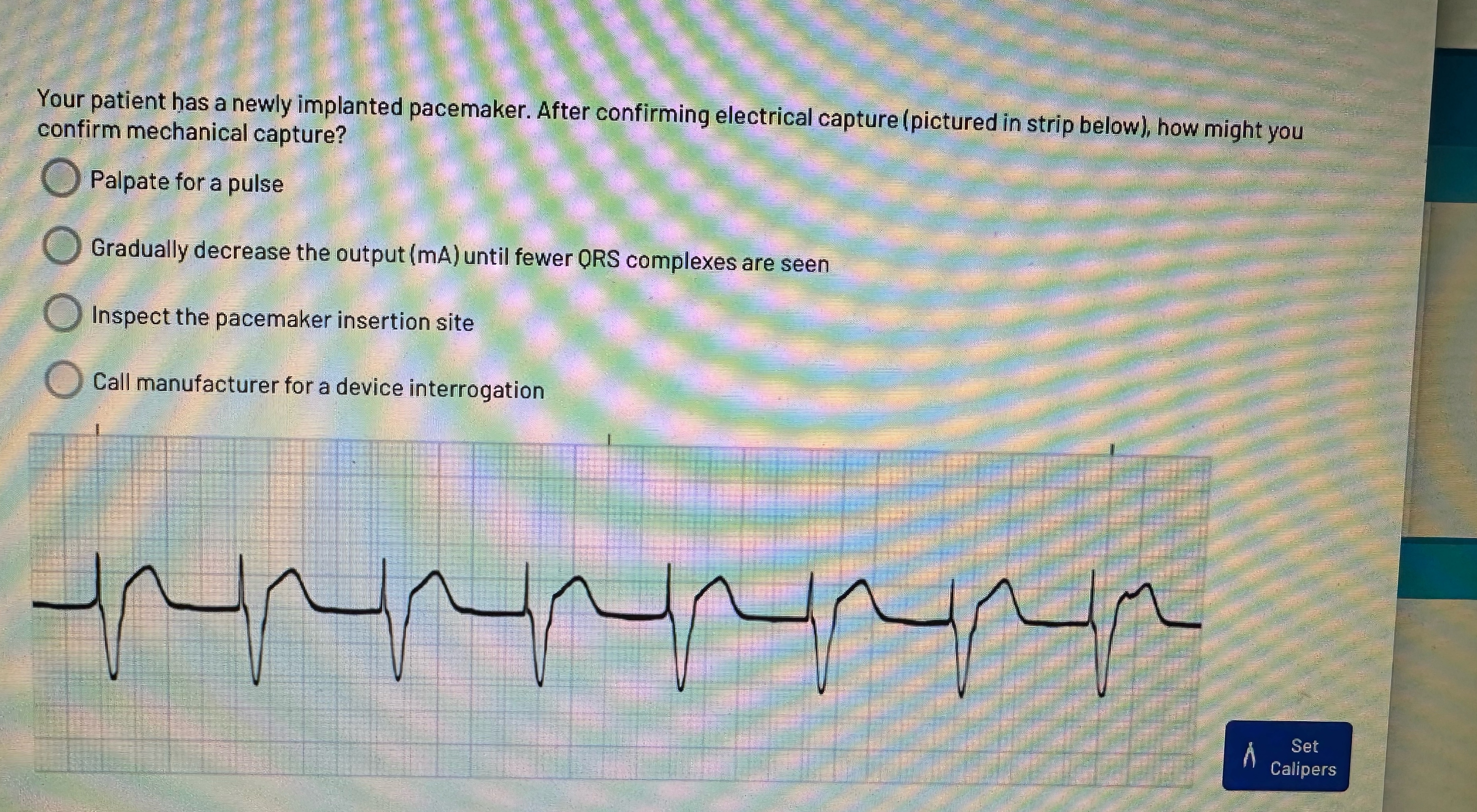 Solved Your patient has a newly implanted pacemaker. After | Chegg.com