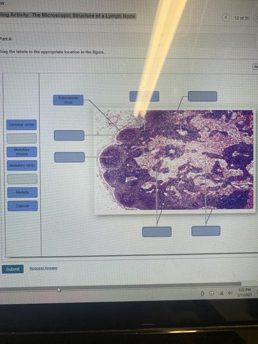 Solved w ling Activity: The Microscopic Structure of a Lymph | Chegg.com