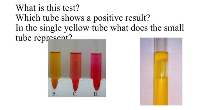 Solved What is this test? Which tube shows a positive | Chegg.com