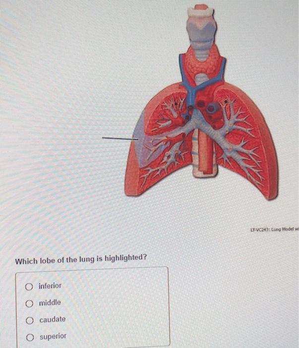 Solved AO LT-HTO: Femalo Pal Which structure is highlighted? | Chegg.com