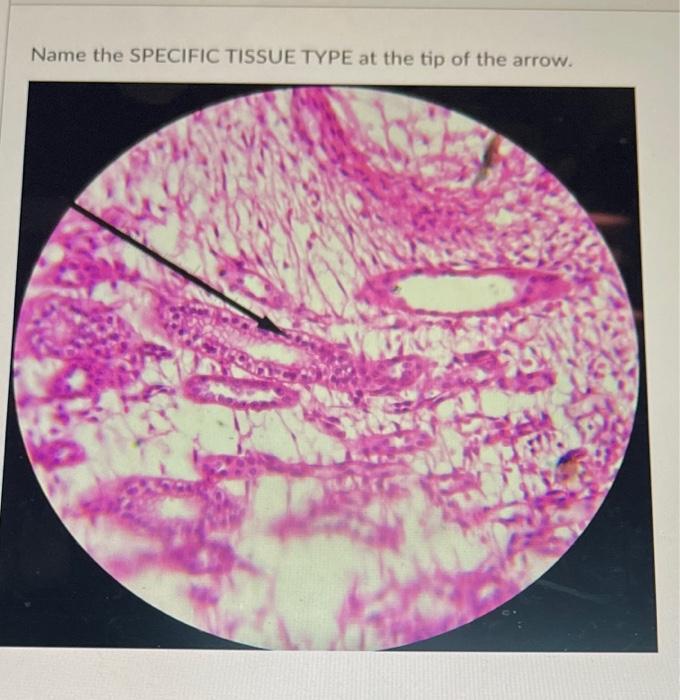 Name the SPECIFIC TISSUE TYPE at the pointer. Name | Chegg.com