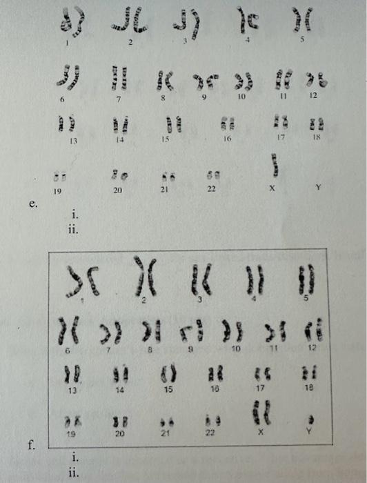 1 Using The Karyotypes Identify The Chromosomal Sex