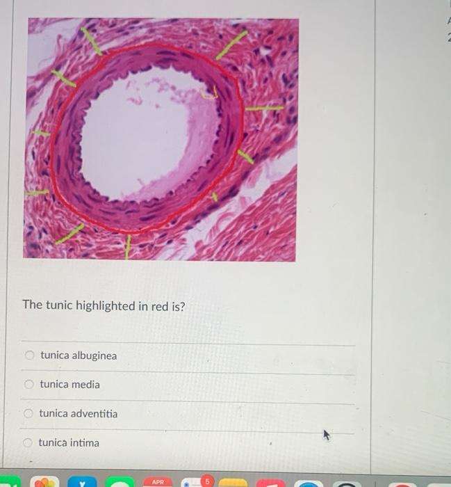 Solved The tunic highlighted in red is? tunica albuginea