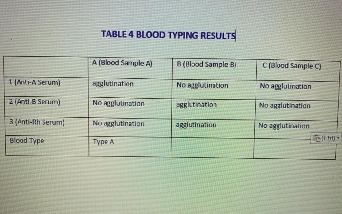 Solved TABLE 4 BLOOD TYPING RESULTS A Blood Sample A B Chegg