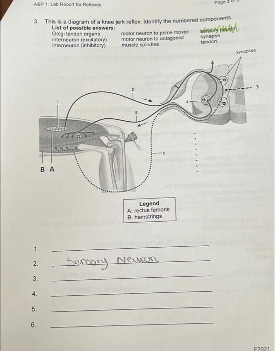 Solved A&P 1 Lab Report for Reflexes Page 3. This is a | Chegg.com