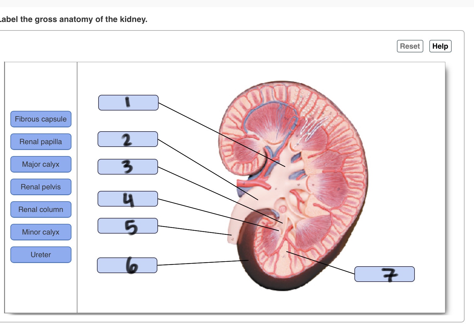 Solved abel the gross anatomy of the kidney. Art-labeling | Chegg.com
