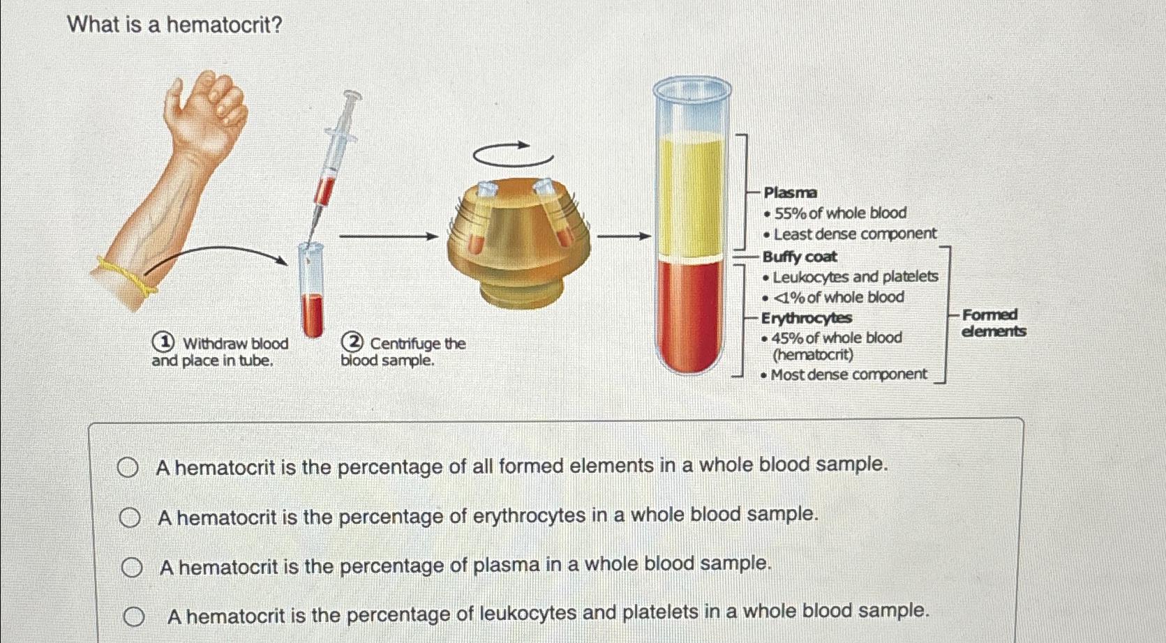 Solved What is a hematocrit?A hematocrit is the percentage