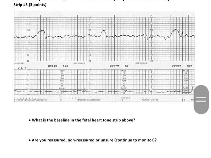 Solved Strip \#3 (3 points) - What is the baseline in the | Chegg.com