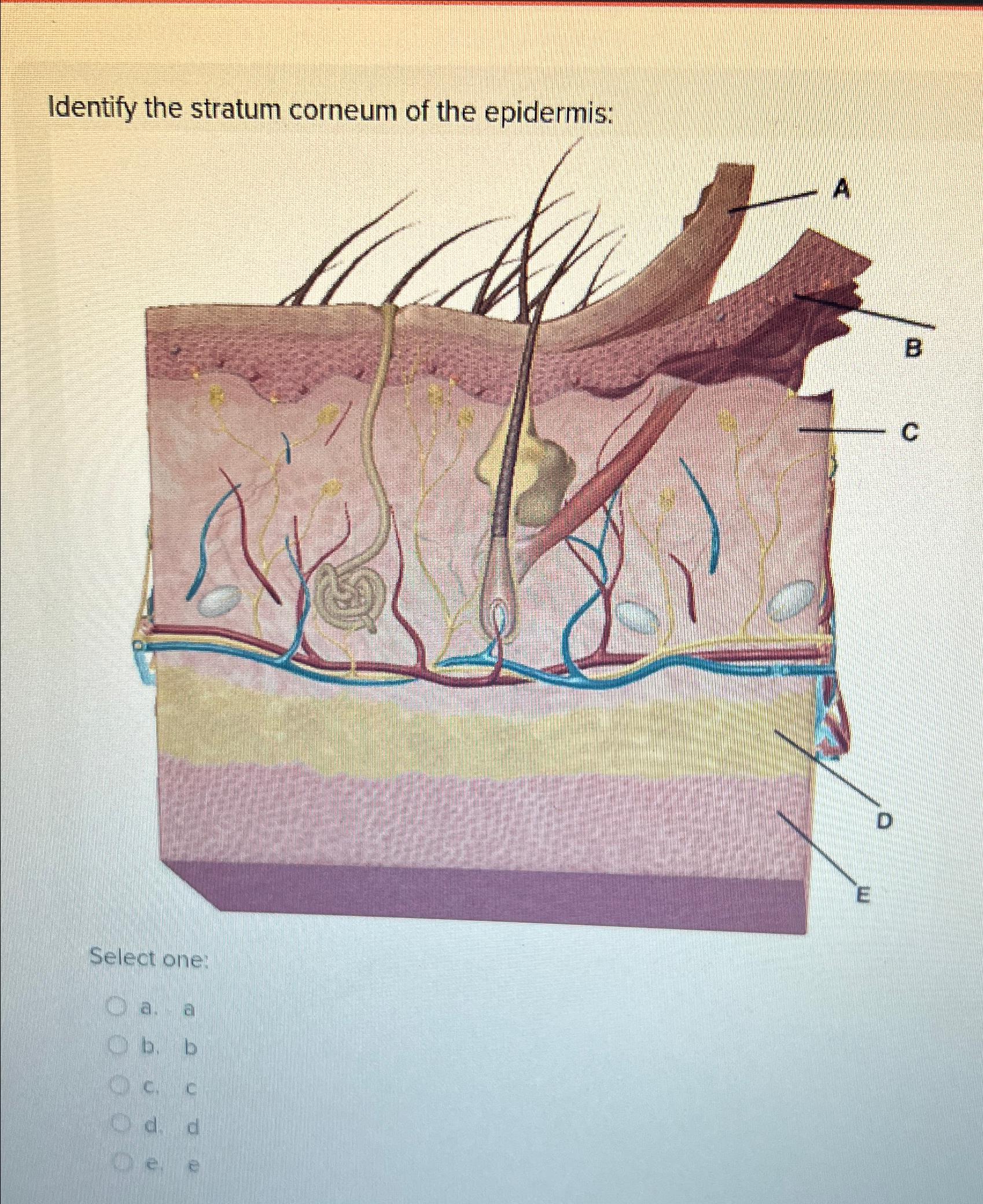 Solved Identify the stratum corneum of the epidermis:Select | Chegg.com