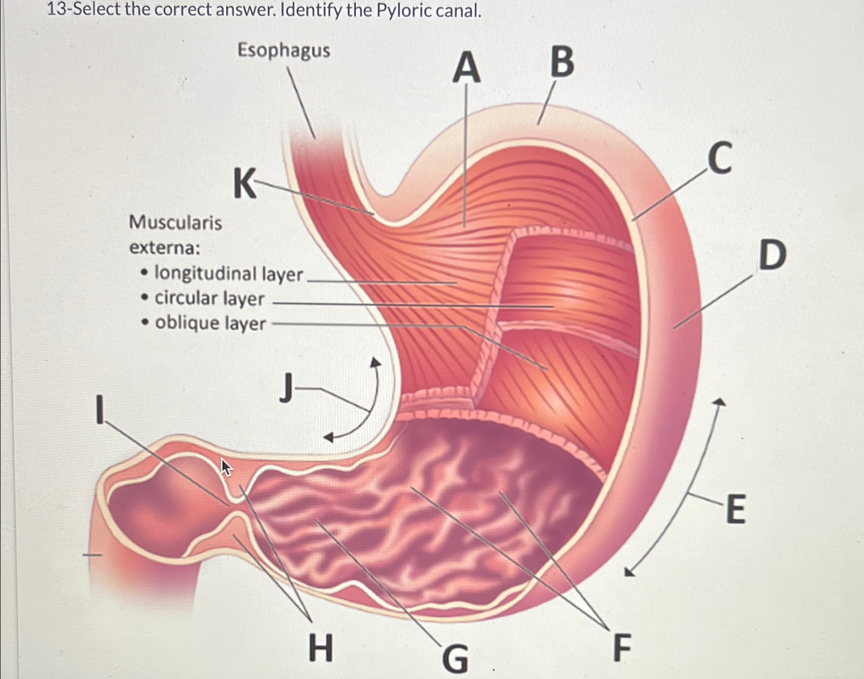 Solved 13-Select the correct answer. Identify the Pyloric | Chegg.com