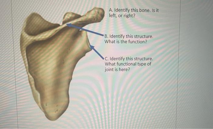 Solved A. Identify this joint What is the structural | Chegg.com