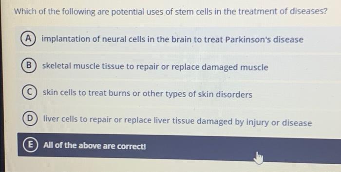 Solved Which of the following are potential uses of stem | Chegg.com