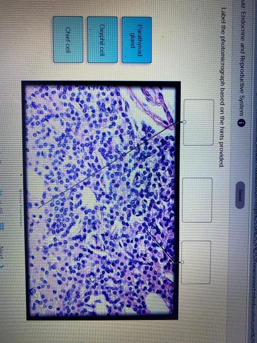 Label the Photomicrograph Using the Hints Provided.