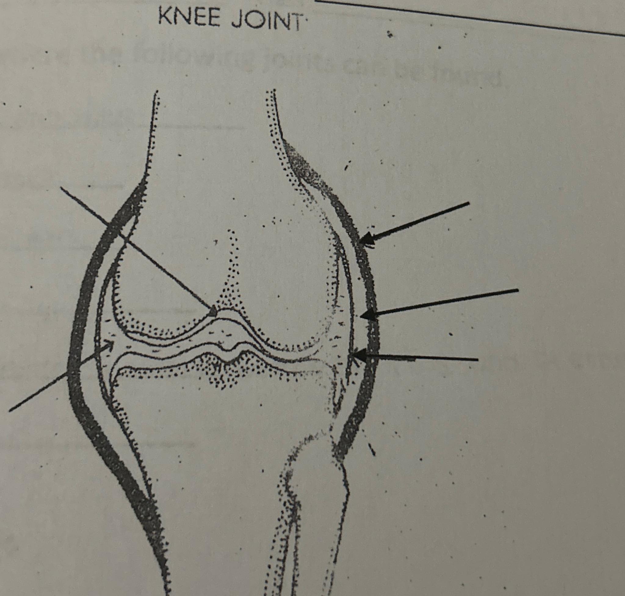 Solved Knee Jointlabel The Diagram 