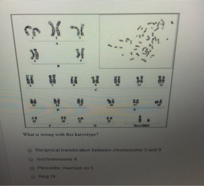 Solved A X What is wrong with this karyotype? Reciprocal | Chegg.com
