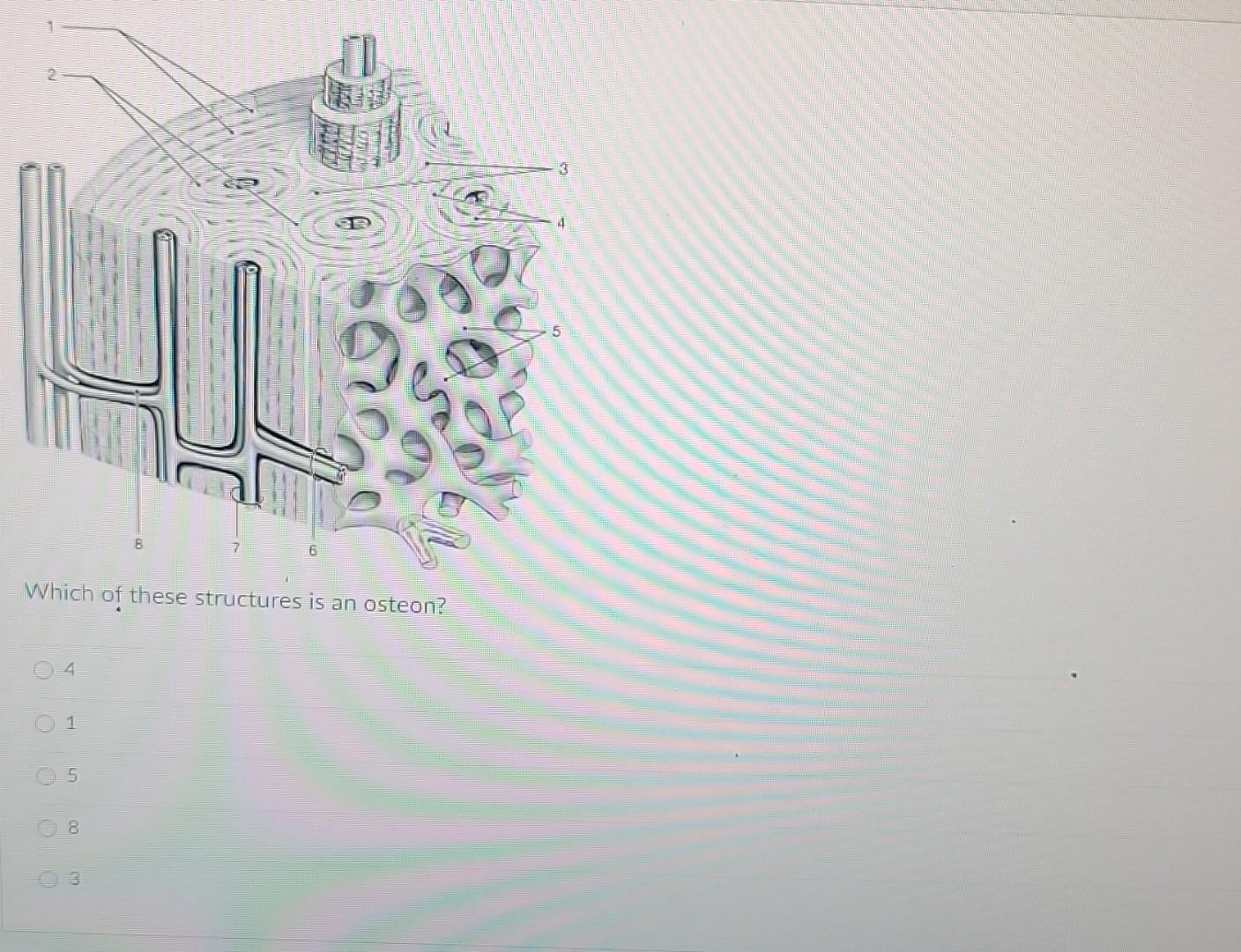 Solved Which of these structures is an osteon? | Chegg.com